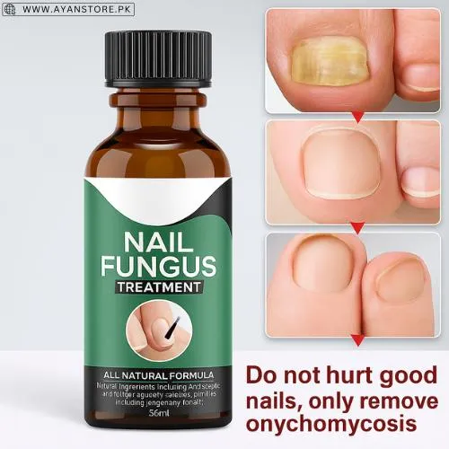 Fast Nail Fungal Treatments Nail Repair Essence Serum