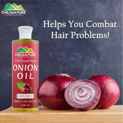 Best Onion Oil For Hair In Pakistan