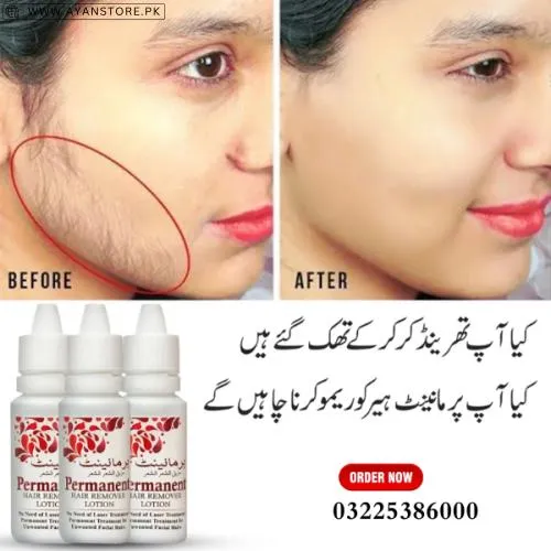 Permanent Hair Remover Lotion