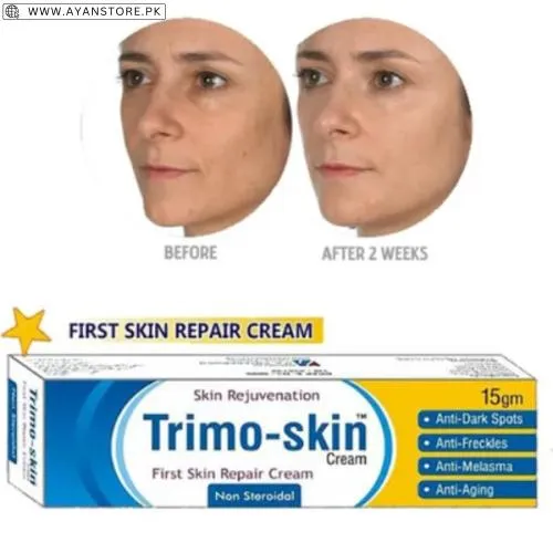 Trimo Skin Cream 