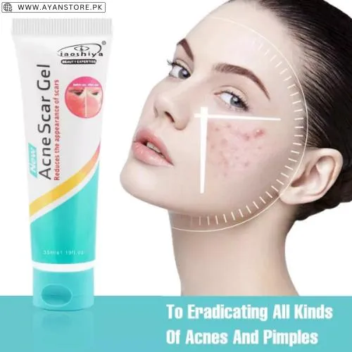 Acne Scar Gel Price In Pakistan