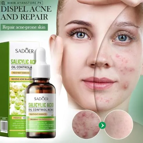 Sadoer Salicylic Acid Oil