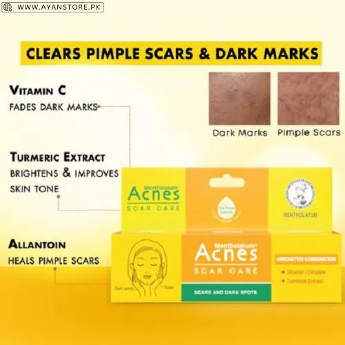 Acnes Scar Care Cream In Pakistan Acnes Scar Care Cream In Pakistan
