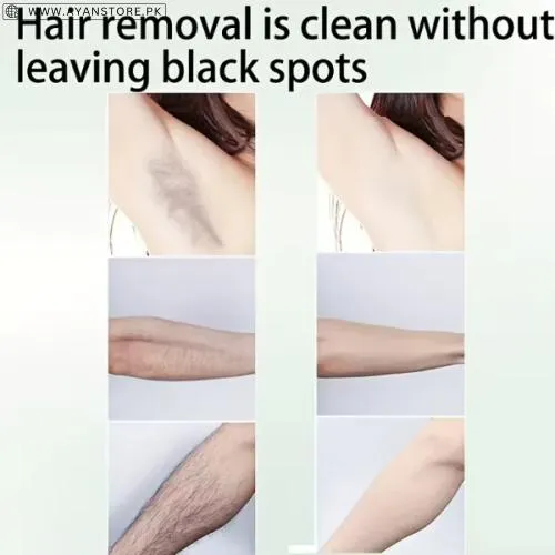 Bosnw Gentle Aloe Vera Hair Removal Cream