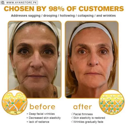 Botox Bee Venom Wrinkle Removal Cream