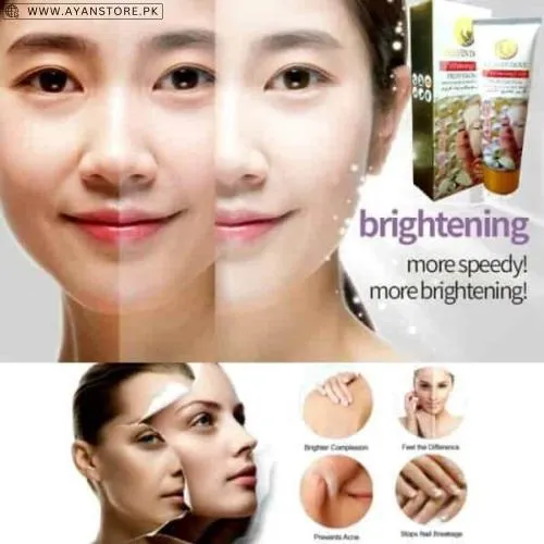 Heaven Dove Whitening Cream Price In Pakistan