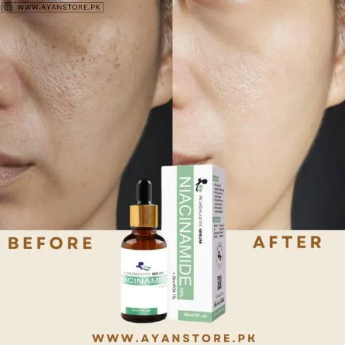 Niacinamide 10% Zinc Pca 1% Skin Serum