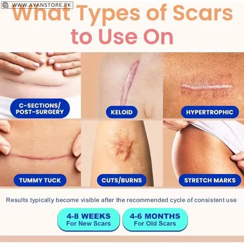Premium Scar Tape For Surgical Marks